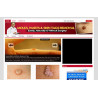 Moles and Warts WP Niche Theme – Free PLR Website